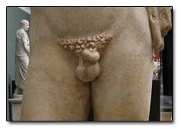 Cringe Wired-Shut Dick.jpg