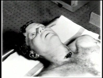 Jfk neck wound.jpg
