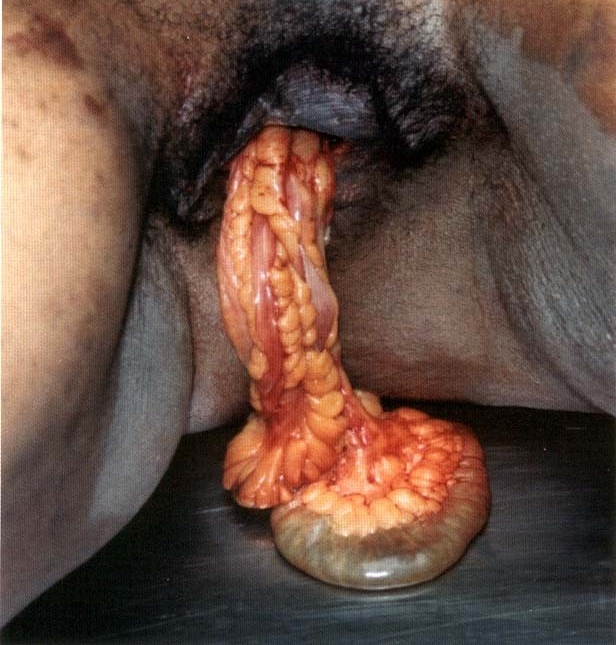 Pain Series Worthy Entrails.jpg