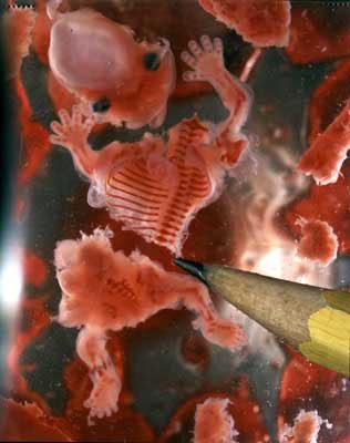 Mommy???  Why didn't you love me?