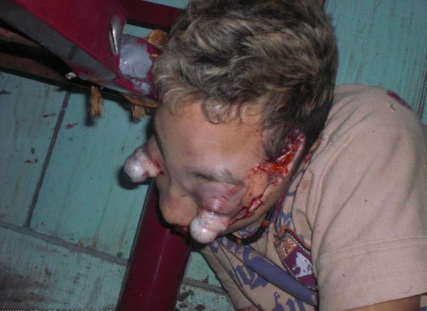 Typical reaction to a shock site.