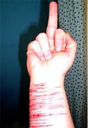 alt=Hannah claims "Its called disability and I work hard to get it" lololol | Hannah claims "Its called disability and I work hard to get it" lololol