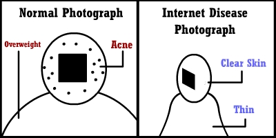 Typical Internet Disease