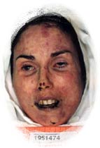 Lisa McPherson After