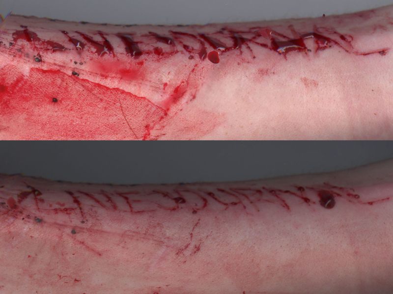 LiveJournal. It dulls the pain.