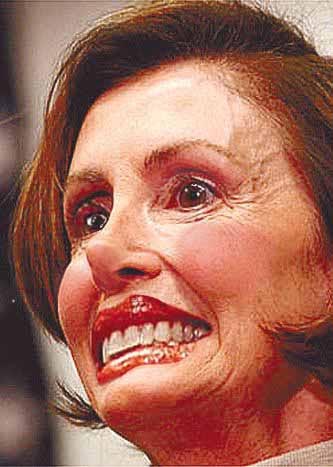 Pelosi - proponent of free plastic surgery.