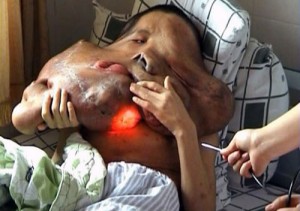 MFW no-one on the internet claims to have my disease